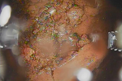 Video and photo footage of the first contact to molten core in Reactor 2