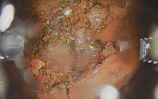 Video and photo footage of the first contact to molten core in Reactor 2